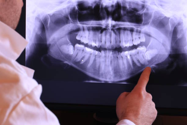 Best Broken or Cracked Tooth Emergency Dentist in Piney Mountain, VA