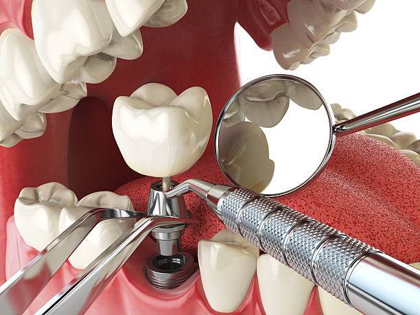 Best Emergency Root Canal Treatment in Piney Mountain, VA
